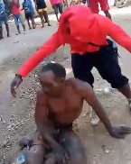 Mob Burns A Man's Penis Off As They Laugh