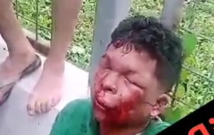 Thief suffer after horrific street justice 