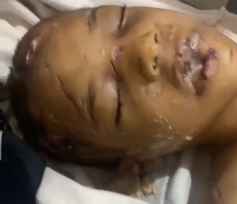 Examination of dead corps of 8years old tortured and butchered by his aunt 