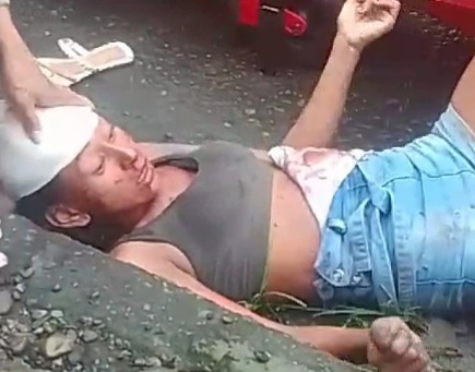 Female Drug user rescued after she had been attacked with machete 