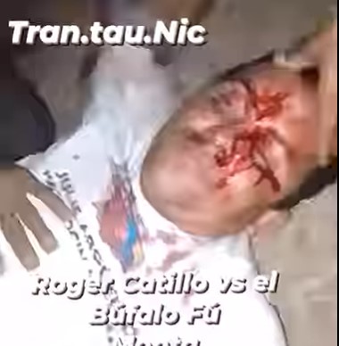 man was knocked down by a ferocious Nicaraguan buffalo