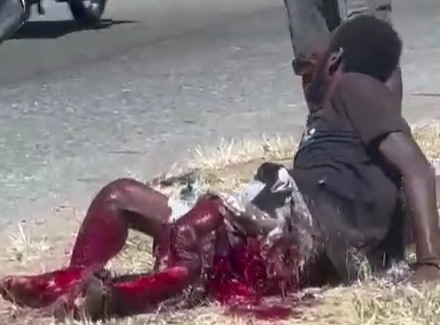 Thief horrifically injured after being hit by a dump truck.  