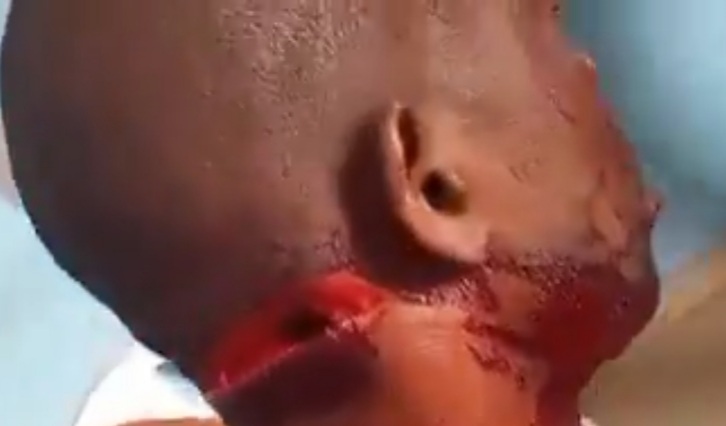 Seriously injured africain man after horrific machete attack 