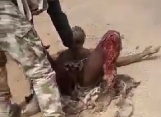 Shattred legs of Nigerian soldier after stepping on landmine 