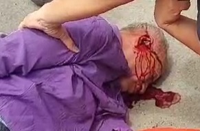 Old man horrifically wounded by speeding motorcycle 