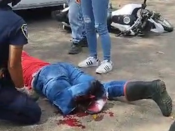 Motorcyclist horribly crashed his leg