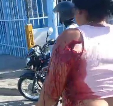 Badly wounded wife defending arrested husband after stabbing her 