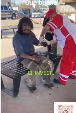 Mexican Beggar has Arm Ripped off