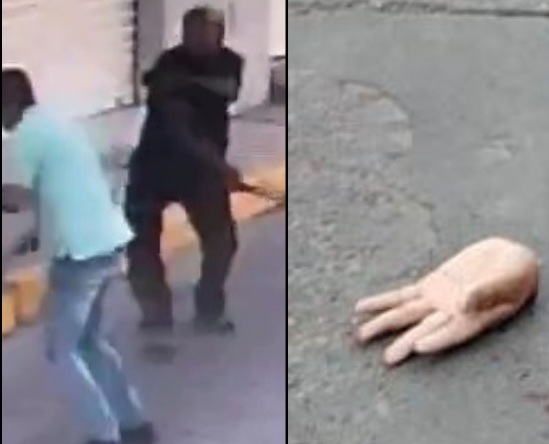 Man Has his Hand Chopped off During Machete Fight 