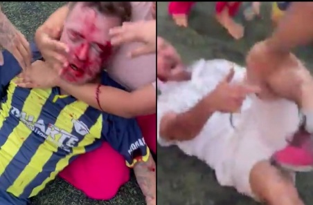 ARGUMENT DURING FOOTBALL GAME ENDED WITH TWO HORRIFIC INJURY 