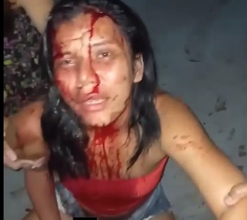 Woman Beaten by her Husband