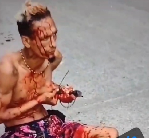 Another video of the stabbed criminal trying to remove the knife 