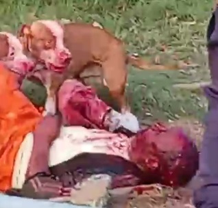 Man Brutally Mauled By Pitbulls, Left Unrecognizable
