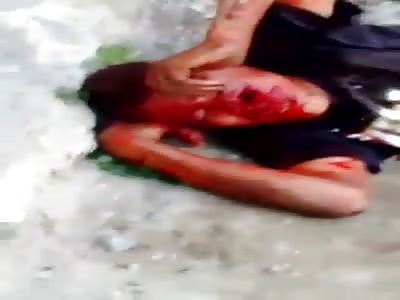 Brutal. Man in Agony Screaming in Pain after Getting Shot in the Face Dying in the Street