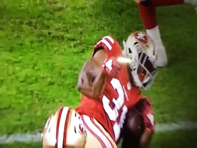 Brutal Broken Arm During NFL Game