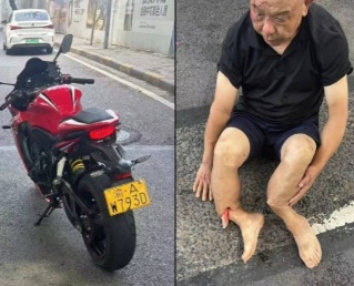Old man legs broken by speeding bike 