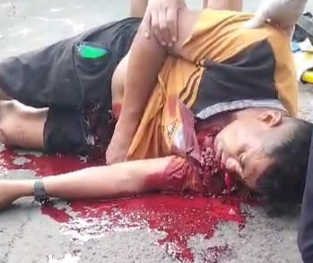 Motorcyclist horrifically injured due to traffic accident 