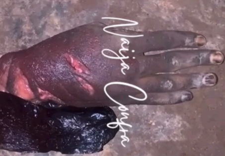 A HAND shopped from dead rival corps killed by the BLACK AXE GANG 