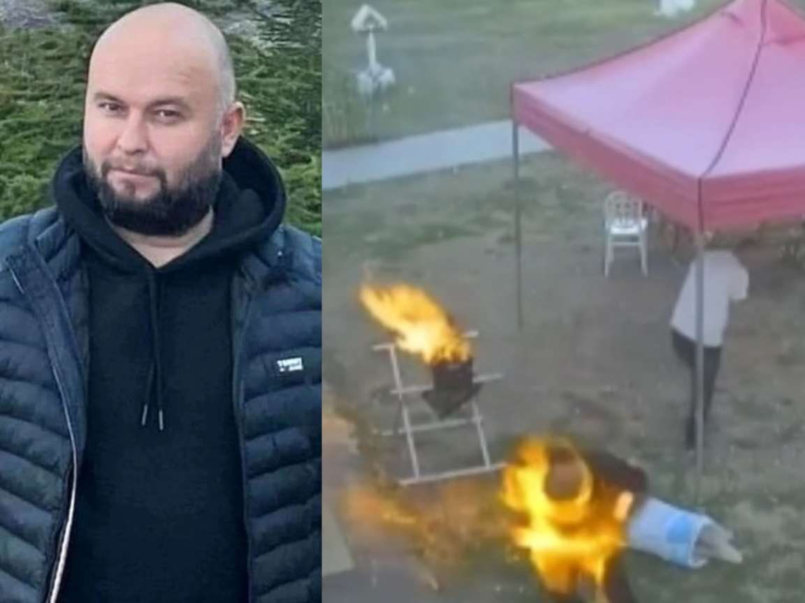 Man Dies Of Heart Attack After Burns From BBQ