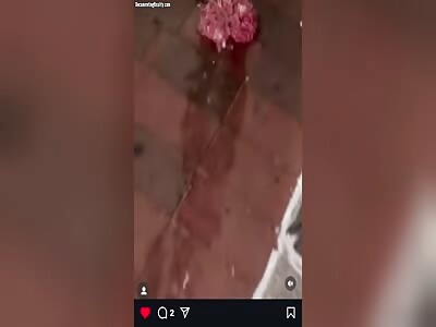 (Repost) Suicide Jumper's Brain Comes Out Of Head