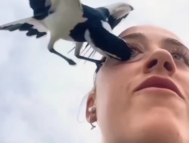 [ANIMALS HATE US] Horrific Bird Attack on Womans Eye.