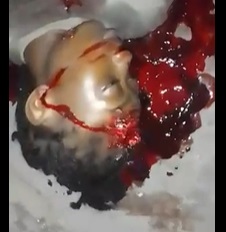 Young Haitian Female Shot In Her Head