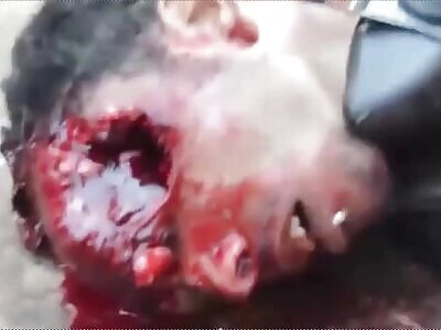 Guy taking his last Breath after Being Shot in the Eye