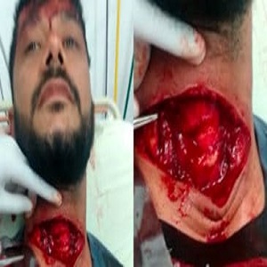 Dude Gets Throat Slit During Kite Accident in Brazil