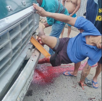 motorcyclist had his leg stuck in the bumper of a truck