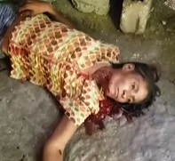 Woman With Her Throat Cut Calmly Slipping Away