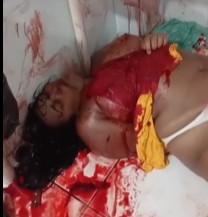 Woman Stabbed In Her Tits & Dying on Camera