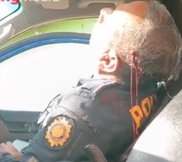 Police Officer Shot In The Head & Leaking Blood