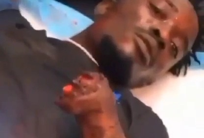 [Hand shopped off]Another victim of Nigerian gangs war 