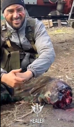 It's fine, just an injury to the leg