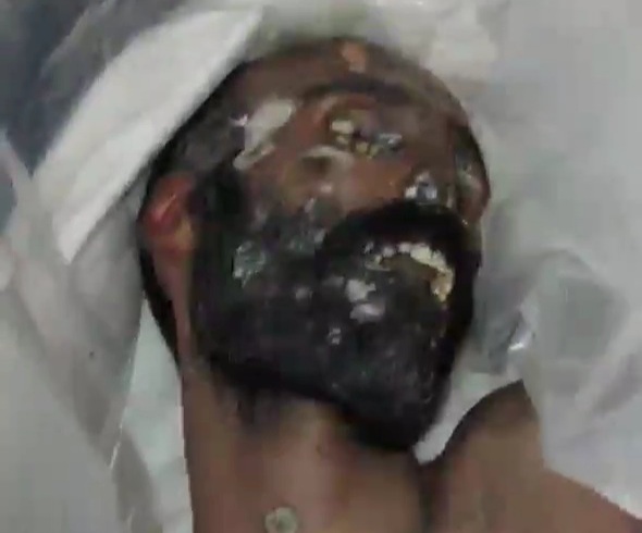 Horrific footage from Syrian prison cellar full pf dead bodies 