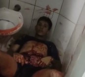 Damn : Dude Cut Open His Stomach In Toilet