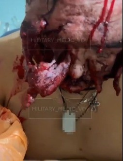 Putin's Victims in the Hospital