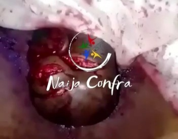 [Head smashed with machete]new victim of the BLACK AXE GANG 