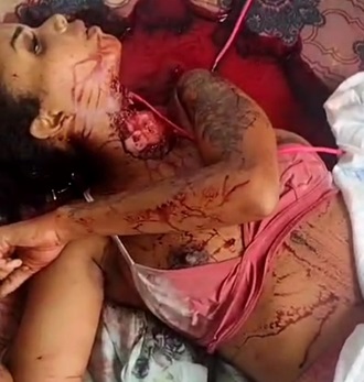 Pretty Girl Stabbed By Boyfriend Dies In Own Blood Bath