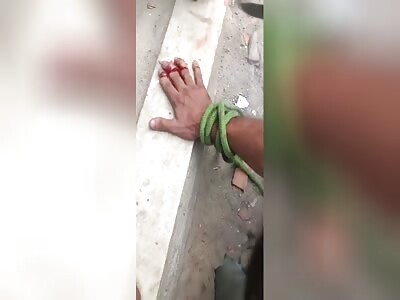 man has finger cut off due to robberies