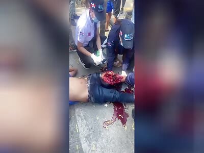 Paramedics Give Emergency Leg Treatment