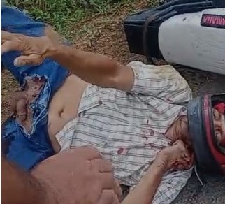 man victim of terrible accident with his dick out