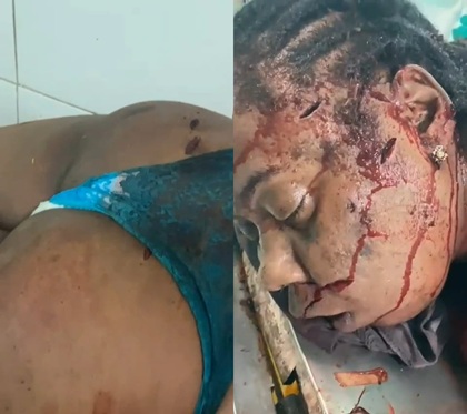 Woman Hacked To Death By Psycho Husband.