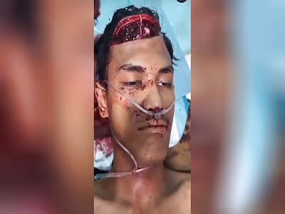 Shocking accident with Victim