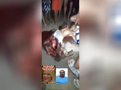victim with legs torn apart in accident 2