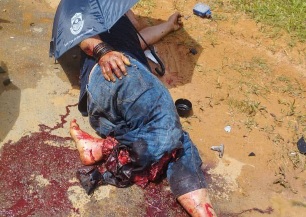 Shattred body of car driver after collision with truck 