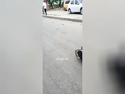 Motorcyclist with body twisted after accident 