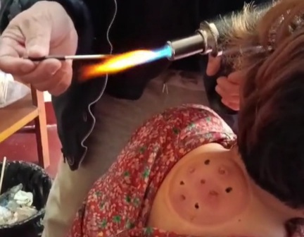 What kind of medical treatment is that????