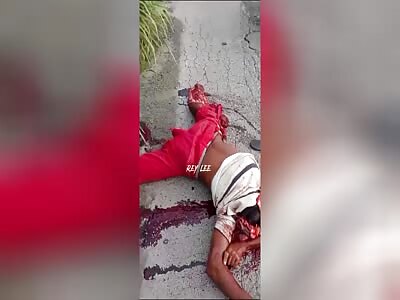 A motorcyclist ends up with his head completely destroyed in a road ac