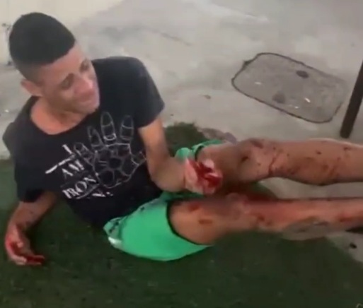 [FAVELA JUSTICE] Hands Smashed with a Sledgehammer 